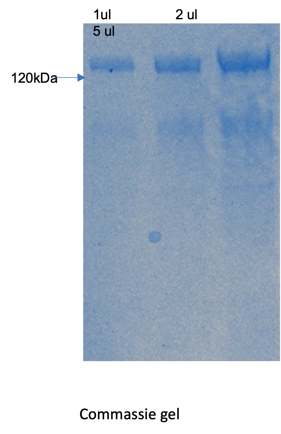 Recombinant Human Brevican Core Protein/BCAN/BEHAB (C-6His)